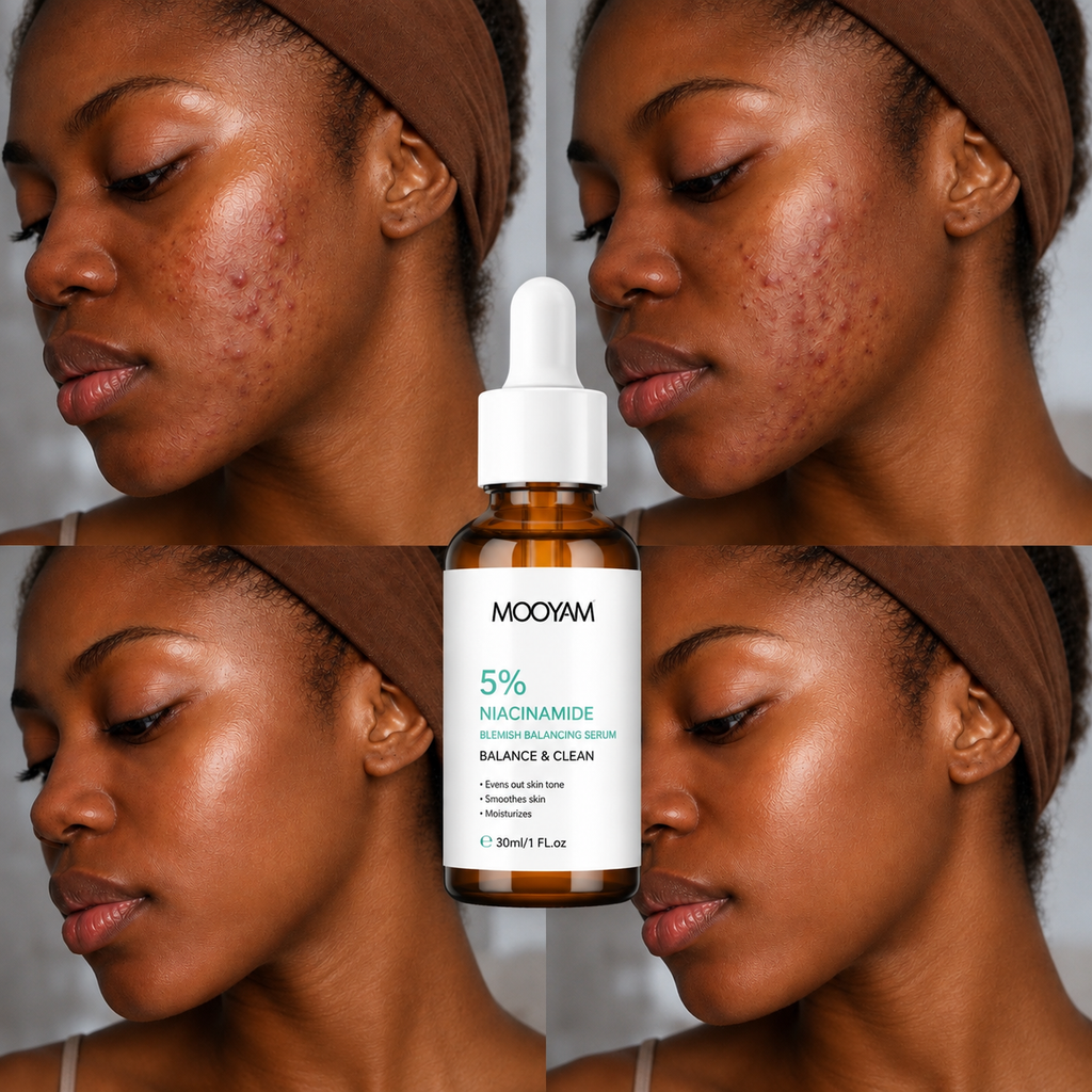 Sérum Niacinamide 5% Anti-Imperfections & Éclat™_
MÔOYAM 30 ml