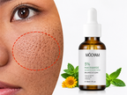 Sérum Niacinamide 5% Anti-Imperfections & Éclat™_
MÔOYAM 30 ml