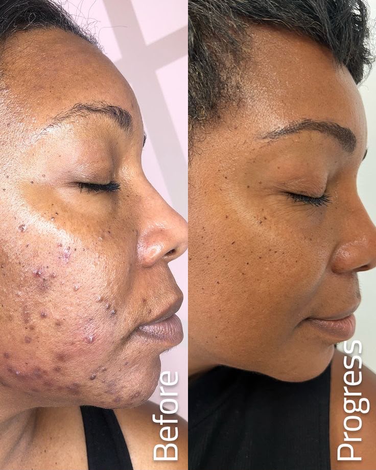 Correcting Glow Serum
